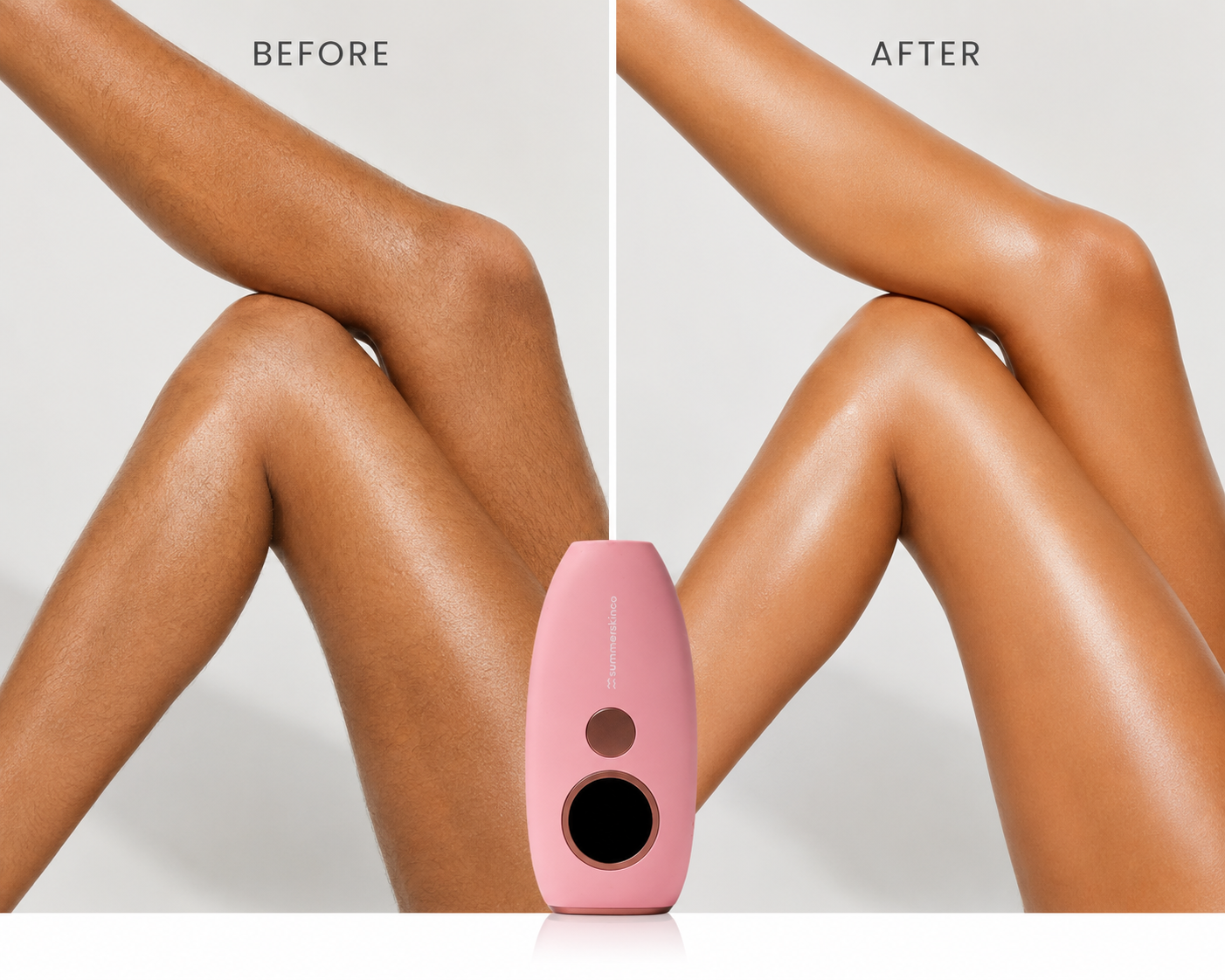 Paloma IPL Hair Removal Device - Confident Smooth Skin